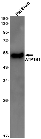 2 - ATP1B1 Rabbit mAb AP75125