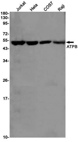 2 - ATPB Rabbit mAb AP75130