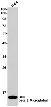 2 - beta 2 Microglobulin Rabbit mAb AP75152