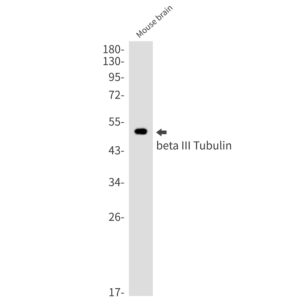 1 - beta III Tubulin Rabbit mAb AP75153