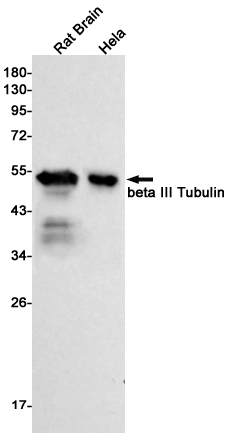 2 - beta III Tubulin Rabbit mAb AP75153