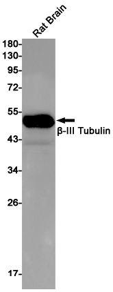 2 - beta III Tubulin Rabbit mAb AP75154