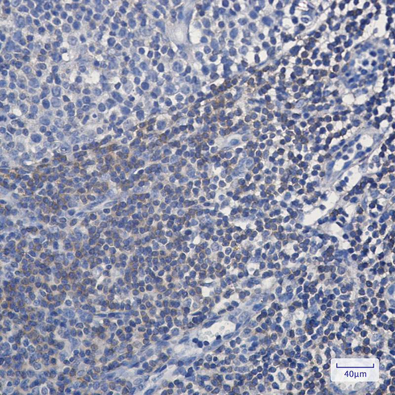 4 - BIN1 Rabbit mAb AP75157
