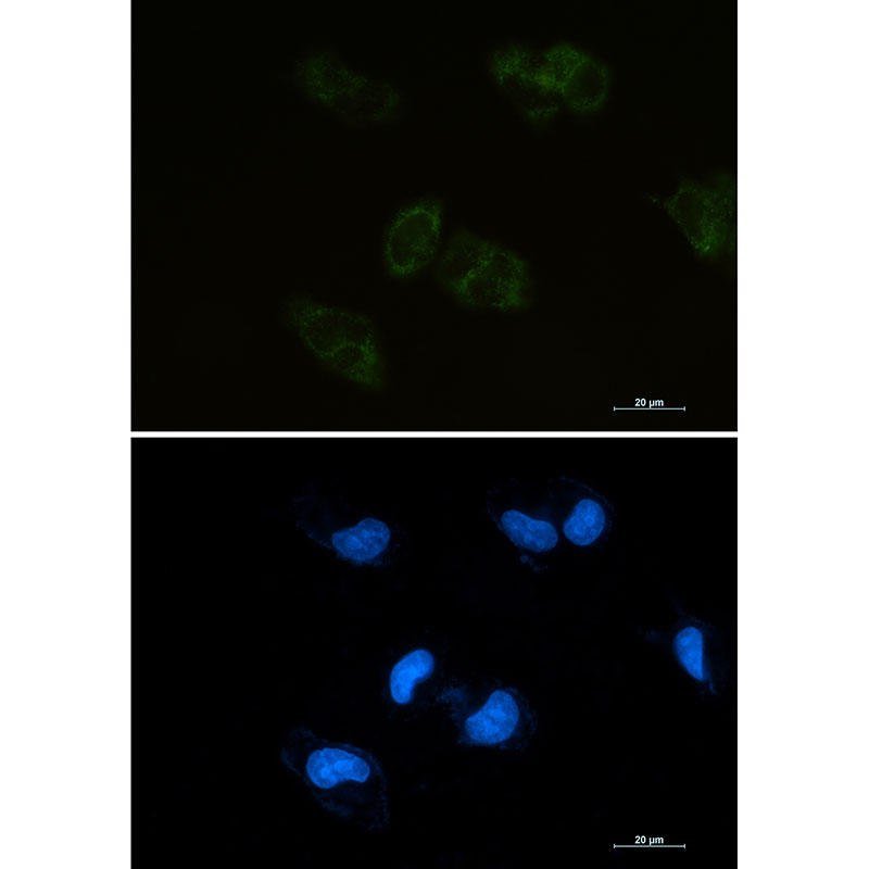1 - BMP4 Rabbit mAb AP75161