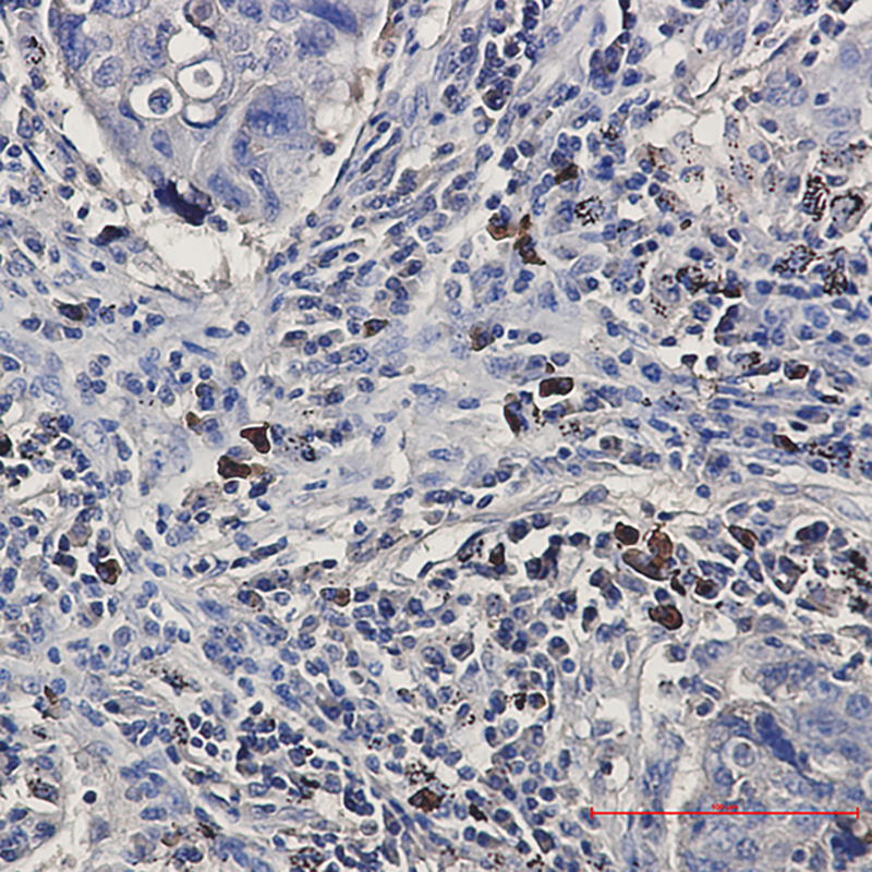 2 - BNIP3L Rabbit mAb AP75162