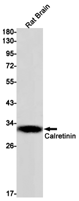1 - Calretinin Rabbit mAb AP75181