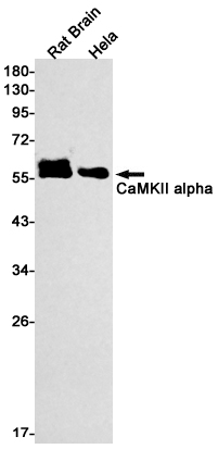 8 - CaMKII alpha Rabbit mAb AP75183
