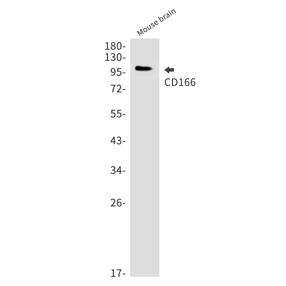 2 - CD166 Rabbit mAb AP75212