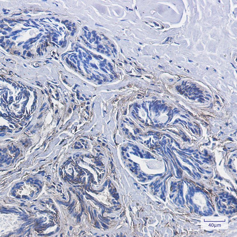 4 - CD99 Rabbit mAb AP75236