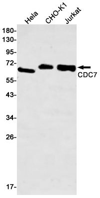 1 - CDC7 Rabbit mAb AP75241