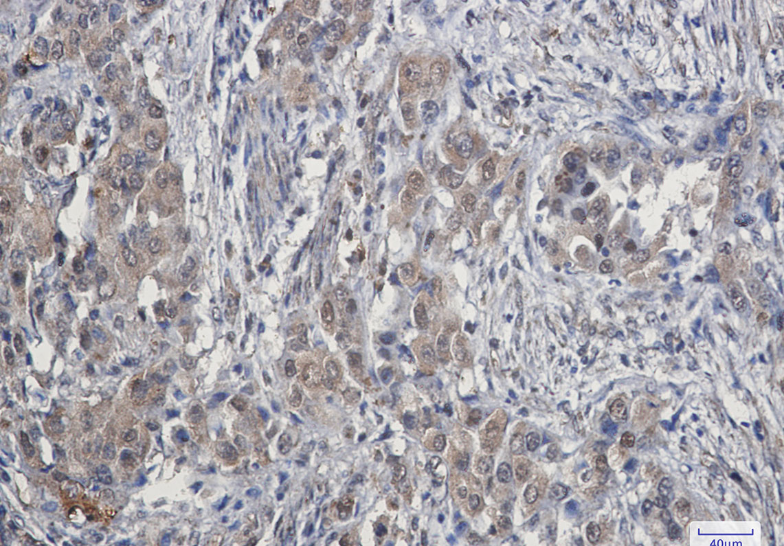 8 - CDK4 Rabbit mAb AP75245