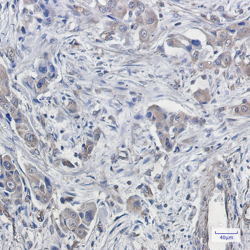 2 - CDT2 Rabbit mAb AP75251