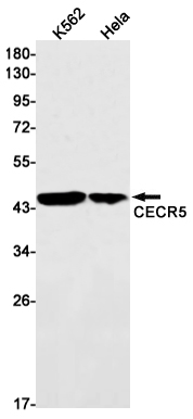1 - CECR5 Rabbit mAb AP75252