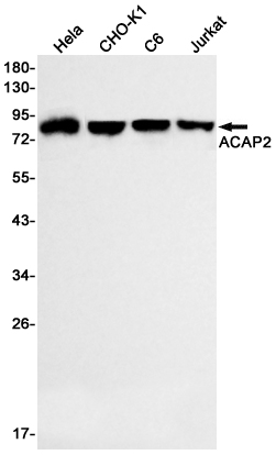 1 - ACAP2 Rabbit mAb AP75256