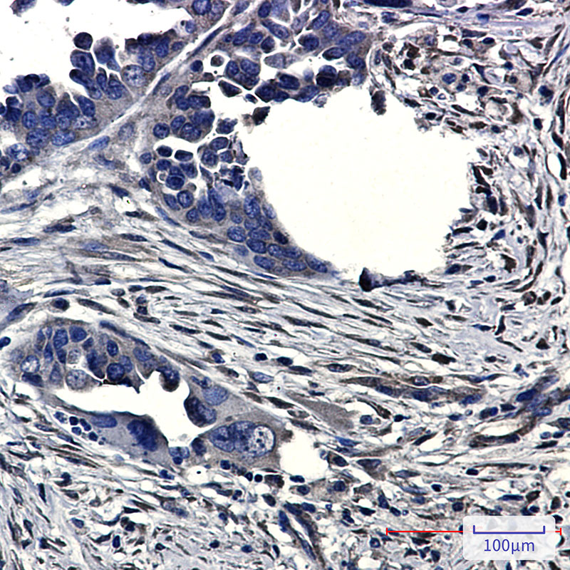 8 - CLIC4 Rabbit mAb AP75271