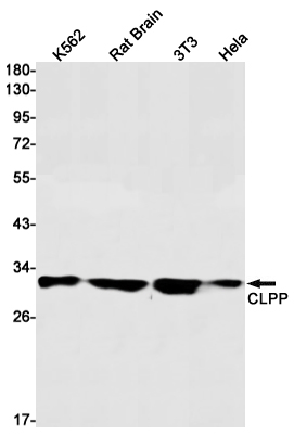 1 - CLPP Rabbit mAb AP75272