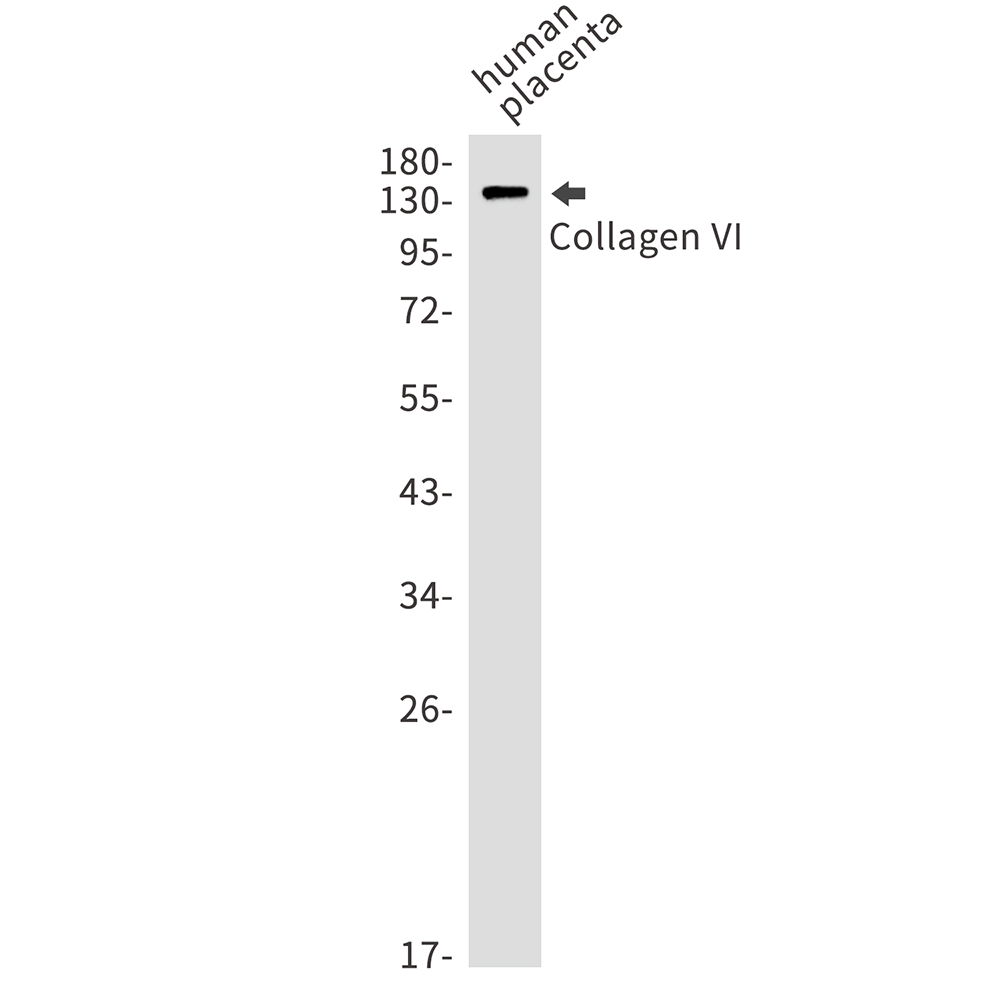 1 - Collagen VI alpha 1 Rabbit mAb AP75279