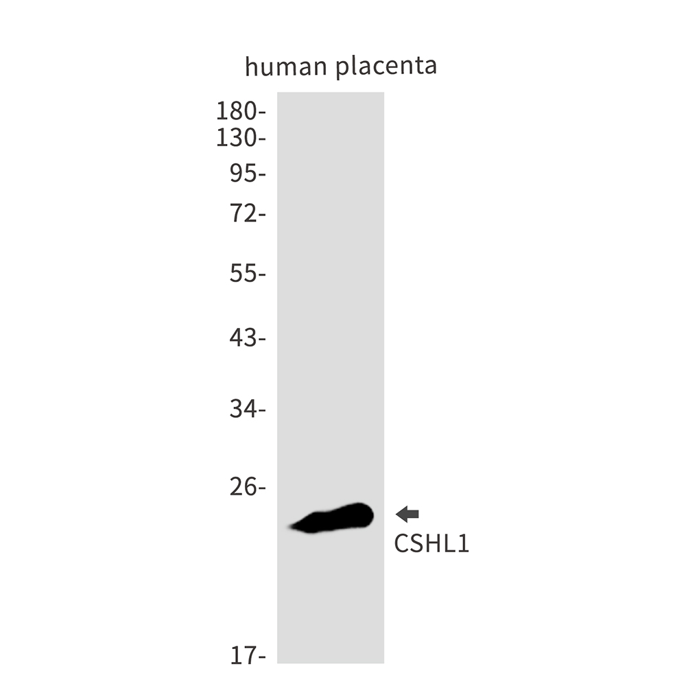 1 - CSHL1 Rabbit mAb AP75295