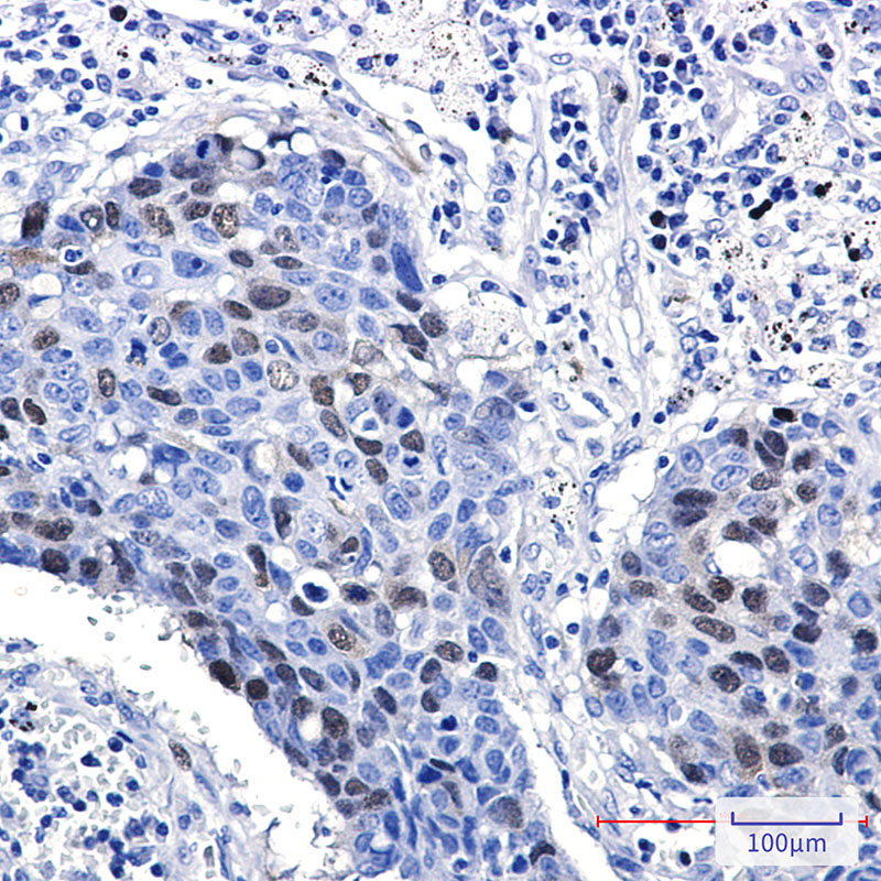 2 - Cyclin A2 Rabbit mAb AP75312