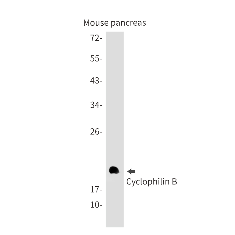 1 - Cyclophilin B Rabbit mAb AP75318