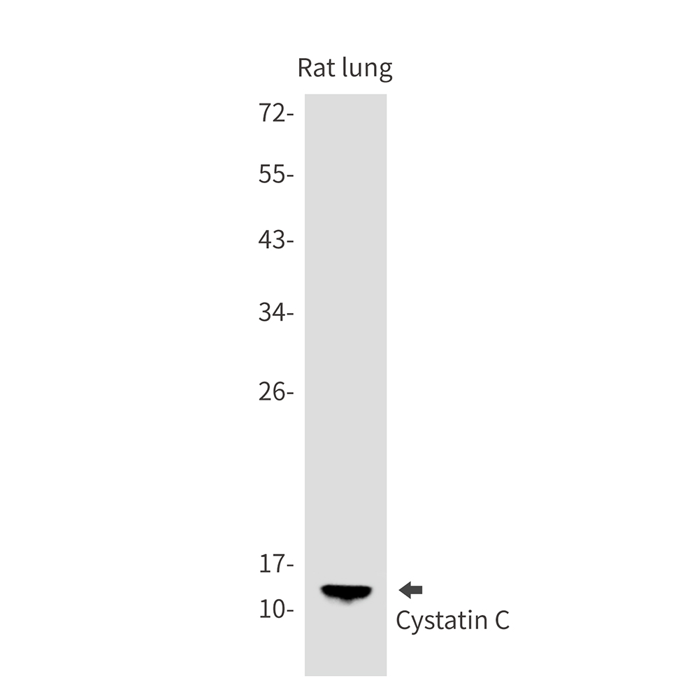 1 - Cystatin C Rabbit mAb AP75322