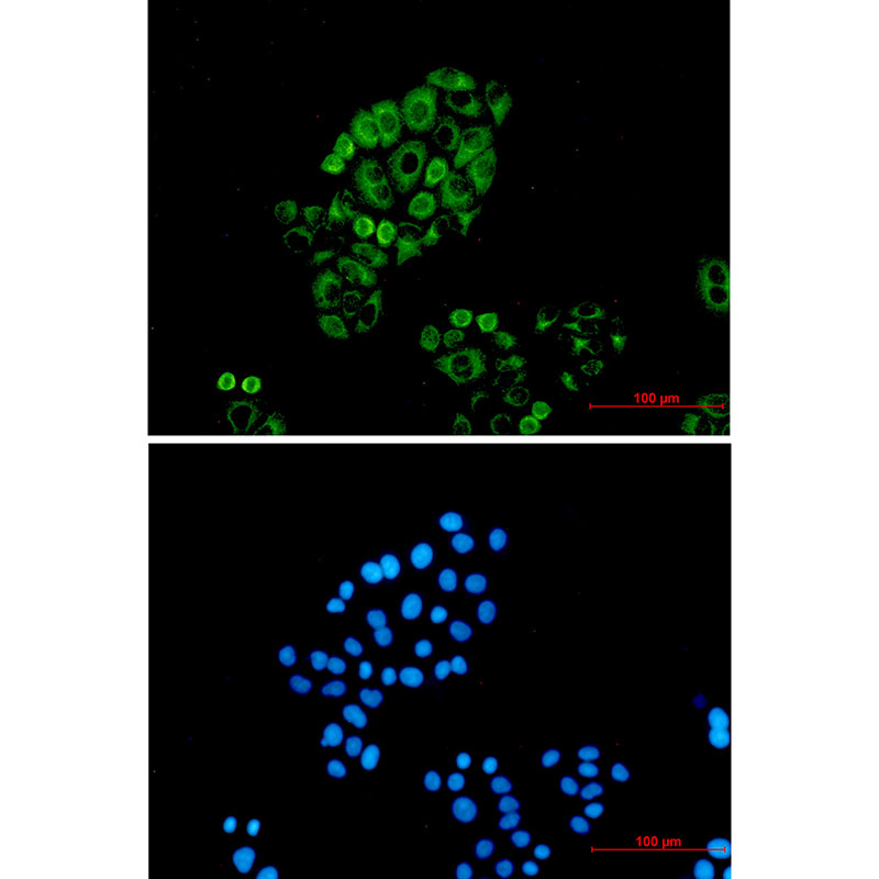 3 - Cytokeratin 18 Rabbit mAb AP75328