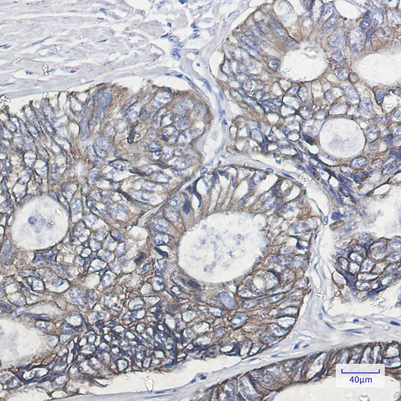 8 - Cytokeratin 19 Rabbit mAb AP75330