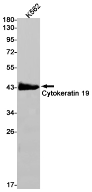 1 - Cytokeratin 19 Rabbit mAb AP75330
