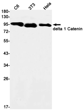 1 - delta 1 Catenin Rabbit mAb AP75350