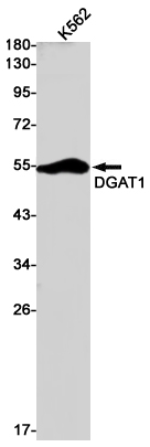 1 - DGAT1 Rabbit mAb AP75354