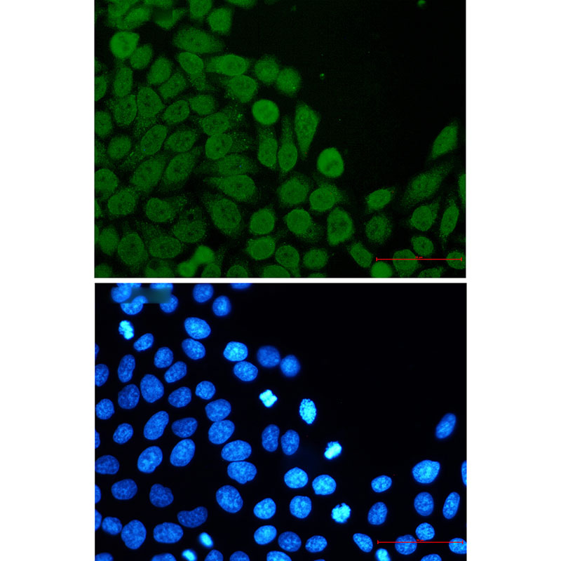 8 - eIF4A3 Rabbit mAb AP75390