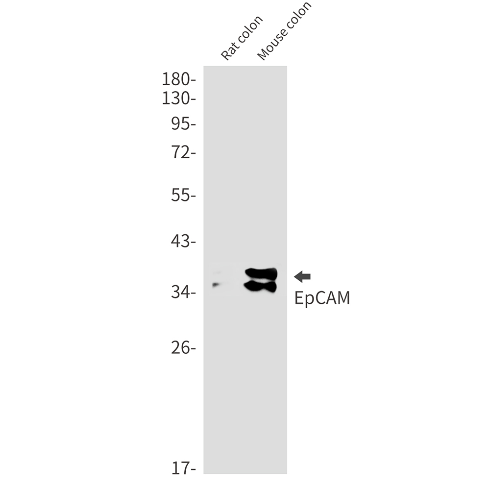 1 - EpCAM Rabbit mAb AP75405