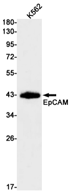 1 - EpCAM Rabbit mAb AP75406