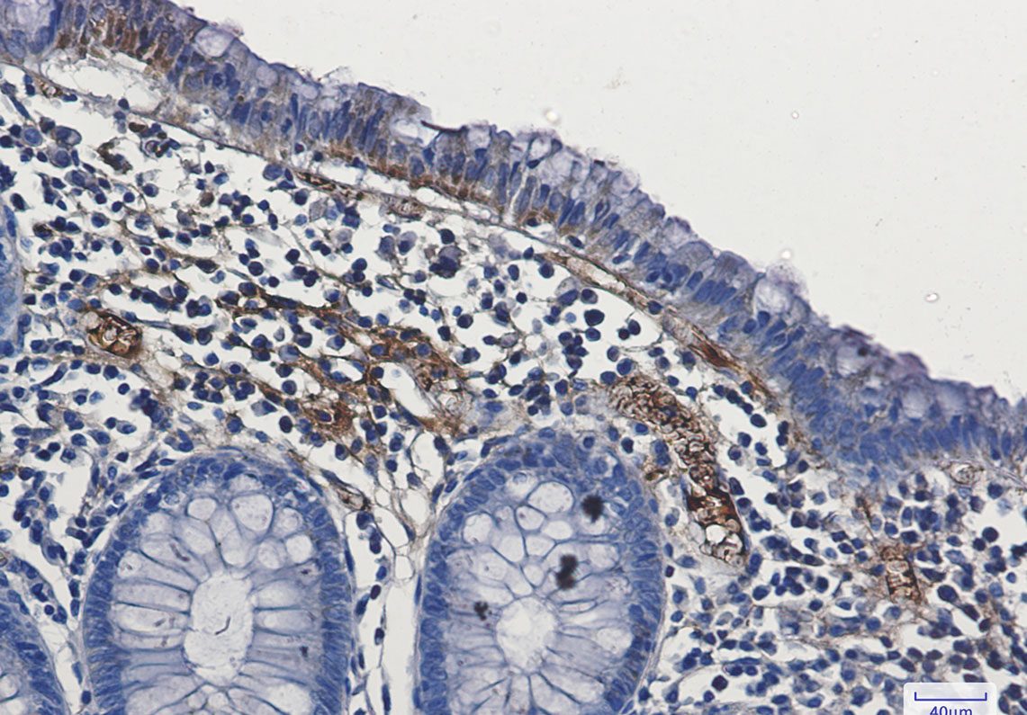 3 - FAK Rabbit mAb AP75423