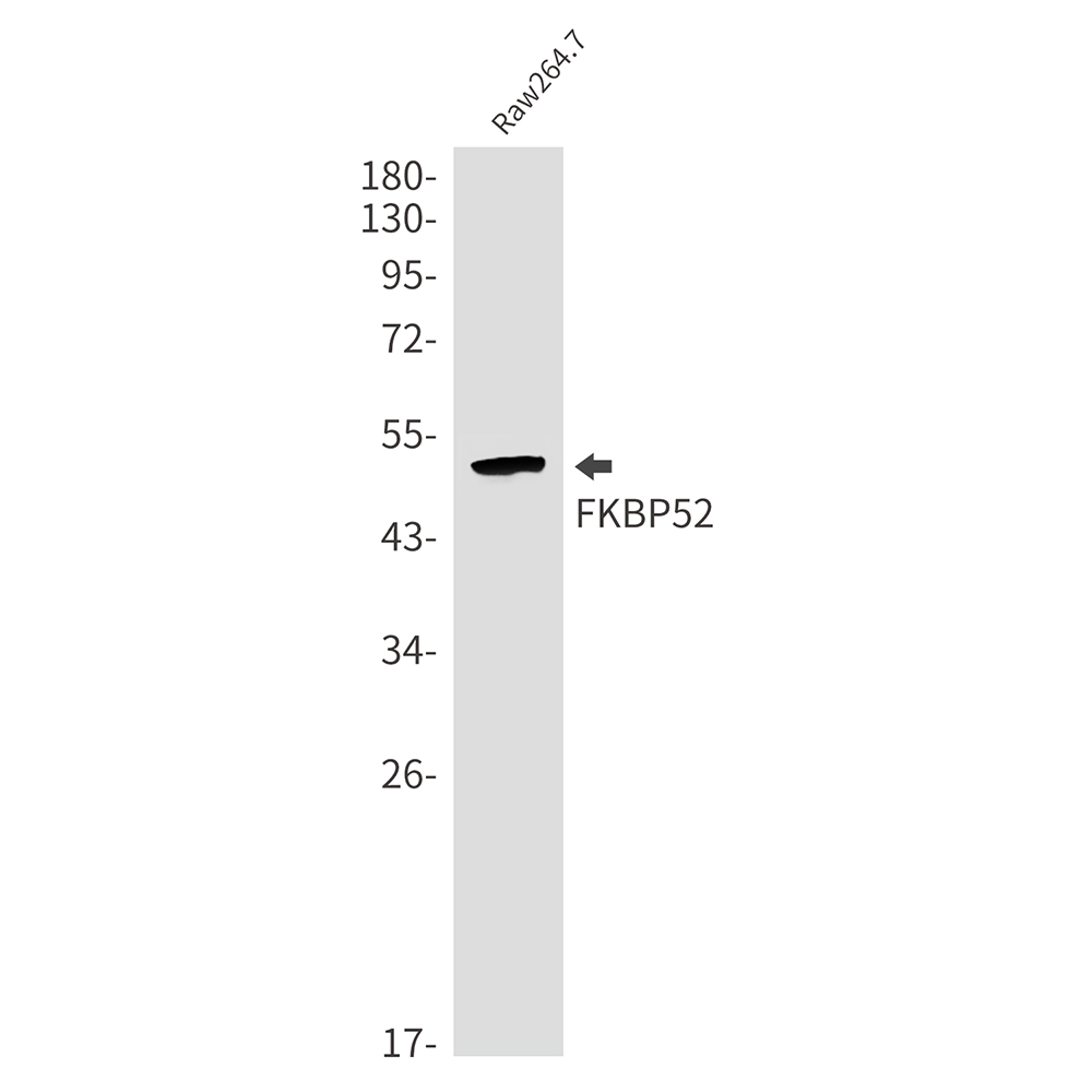 1 - FKBP52 Rabbit mAb AP75441