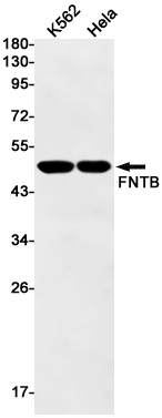 1 - FNTB Rabbit mAb AP75446