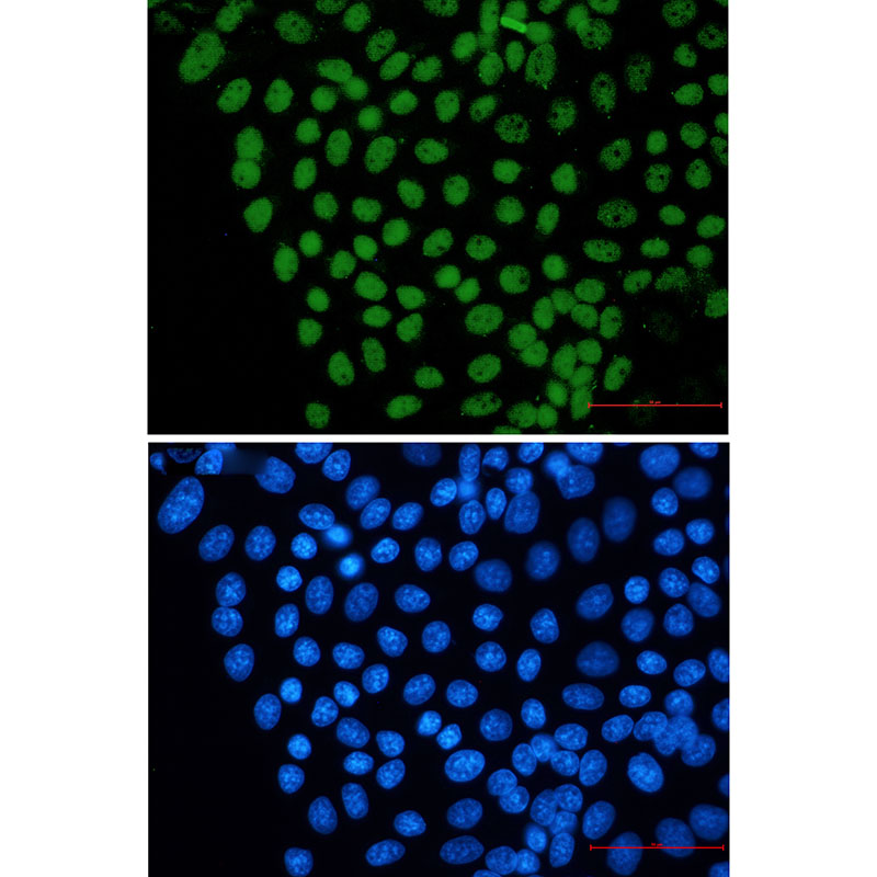 8 - FTO Rabbit mAb AP75458