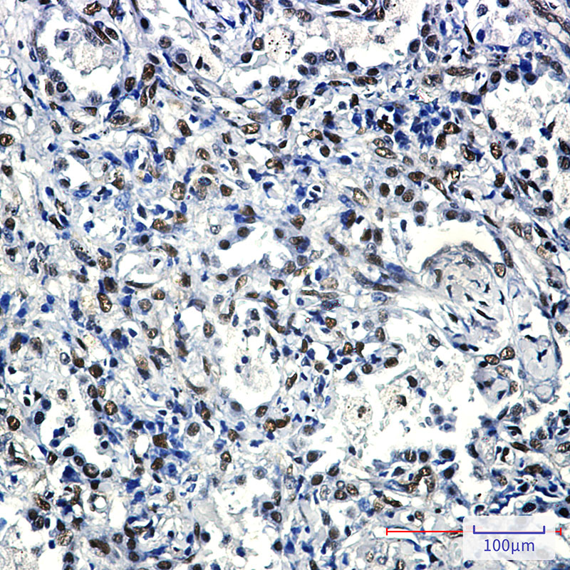 2 - FTO Rabbit mAb AP75458