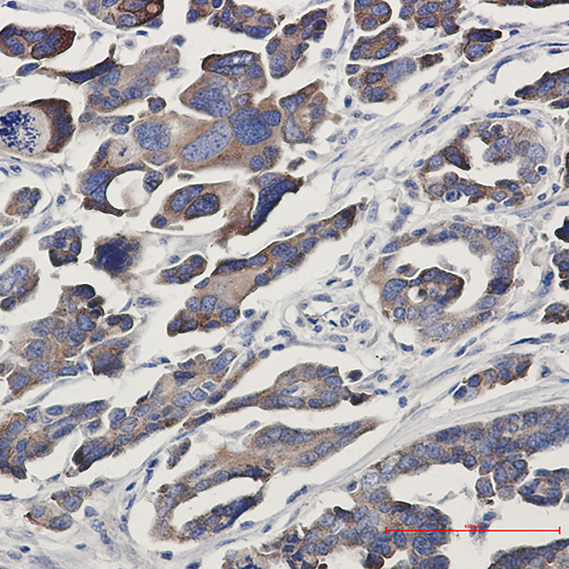 2 - GFPT1 Rabbit mAb AP75488