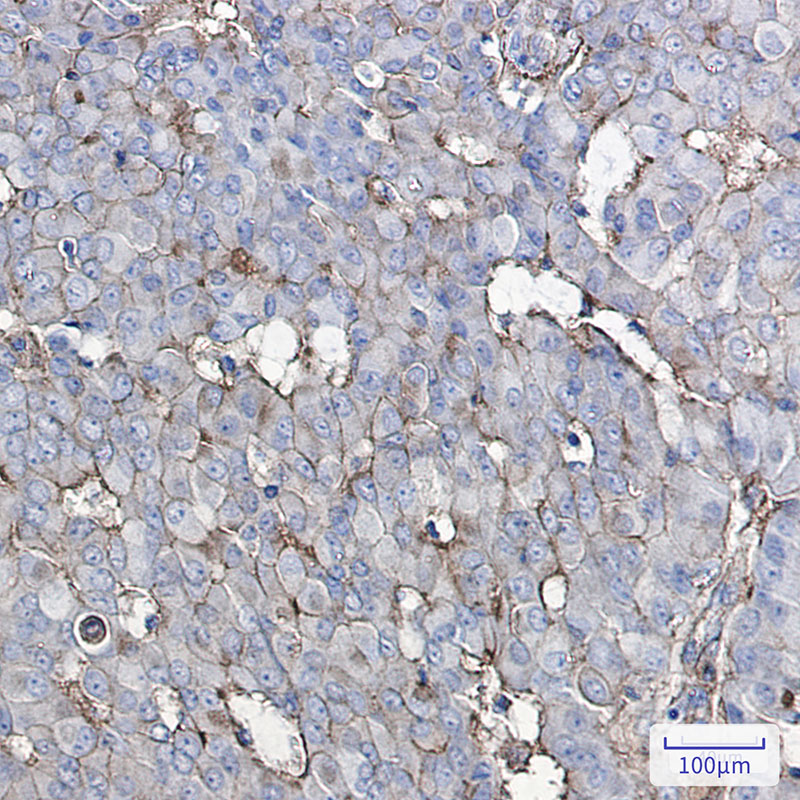 2 - GNAQ Rabbit mAb AP75508