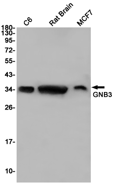 2 - GNB3 Rabbit mAb AP75510