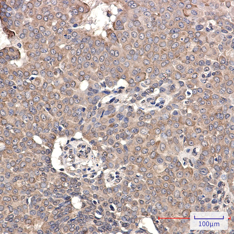 2 - GRP78 BiP Rabbit mAb AP75519