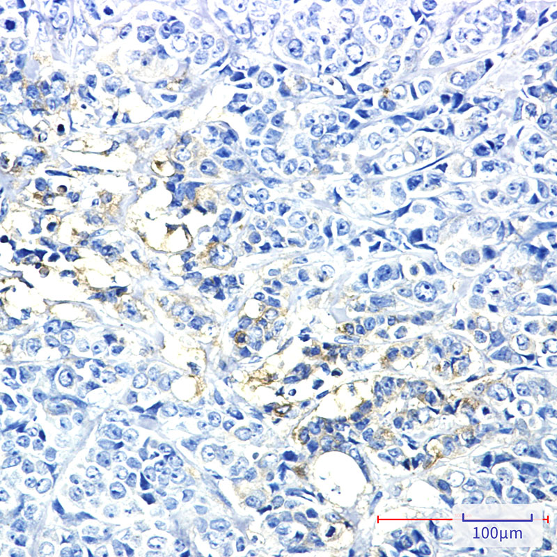 4 - Hexokinase II Rabbit mAb AP75536