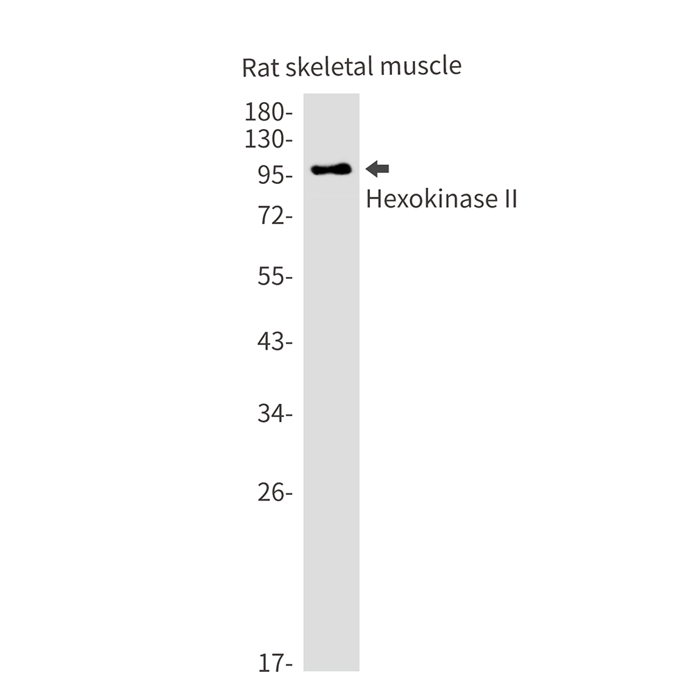 1 - Hexokinase II Rabbit mAb AP75536