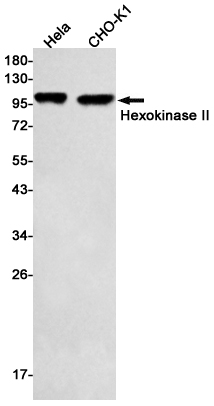 2 - Hexokinase II Rabbit mAb AP75536