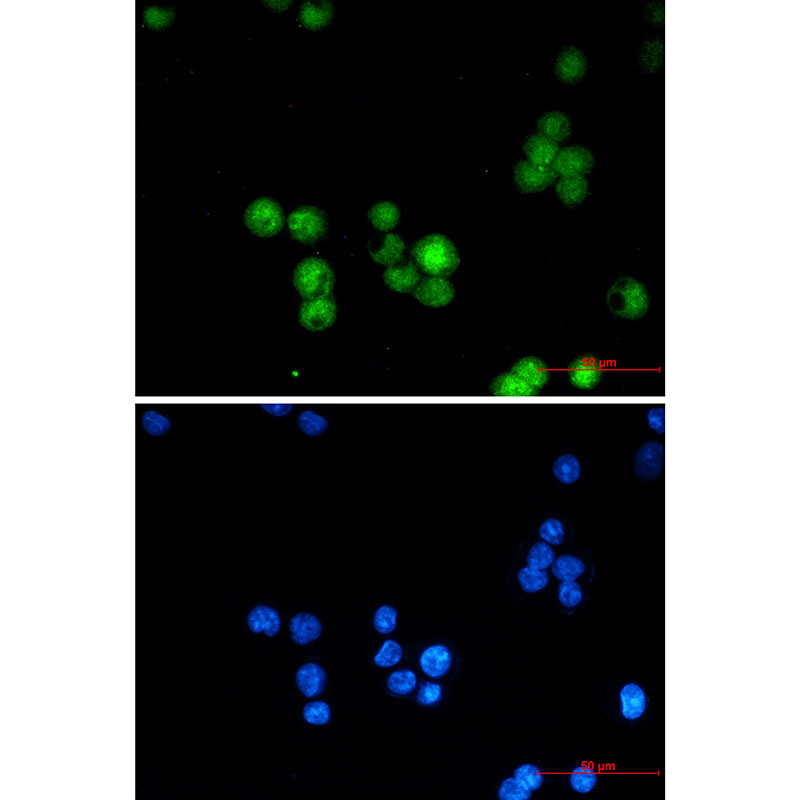 4 - hnRNP K Rabbit mAb AP75563