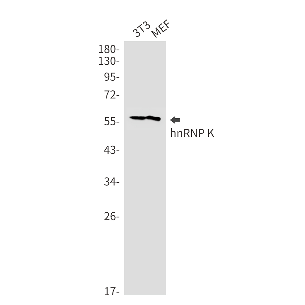 1 - hnRNP K Rabbit mAb AP75563