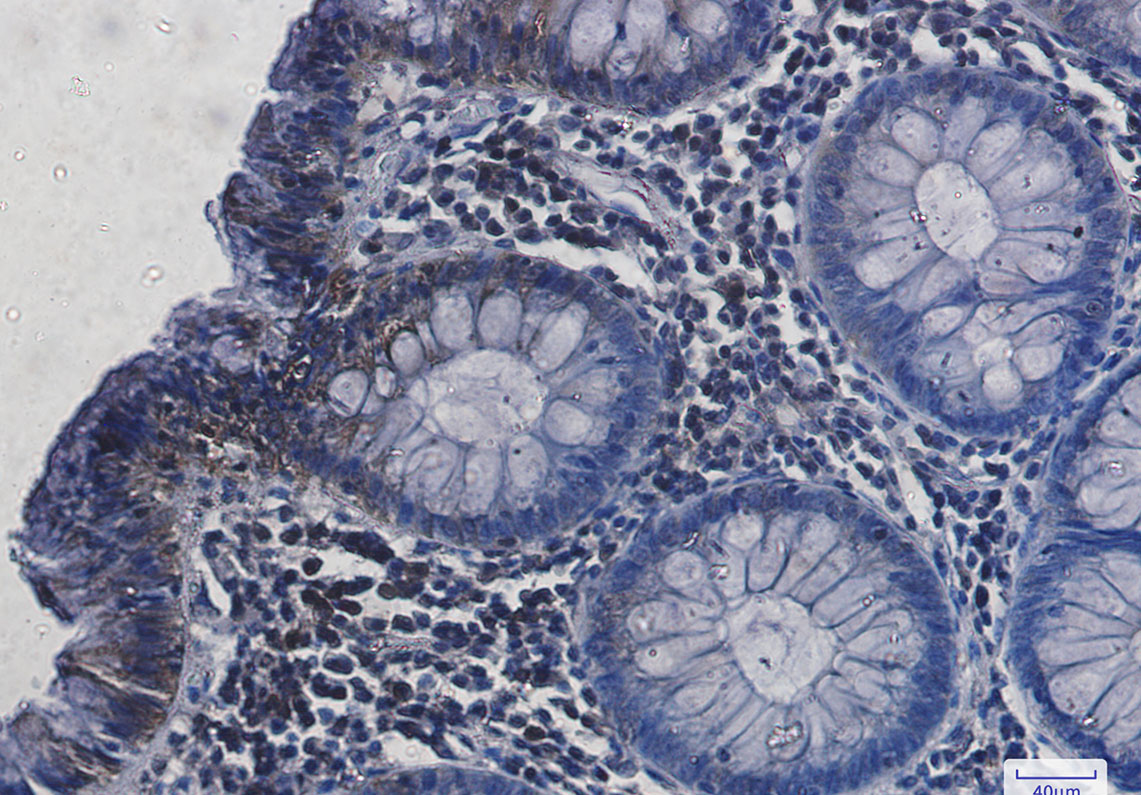 4 - Hsc70 Rabbit mAb AP75575