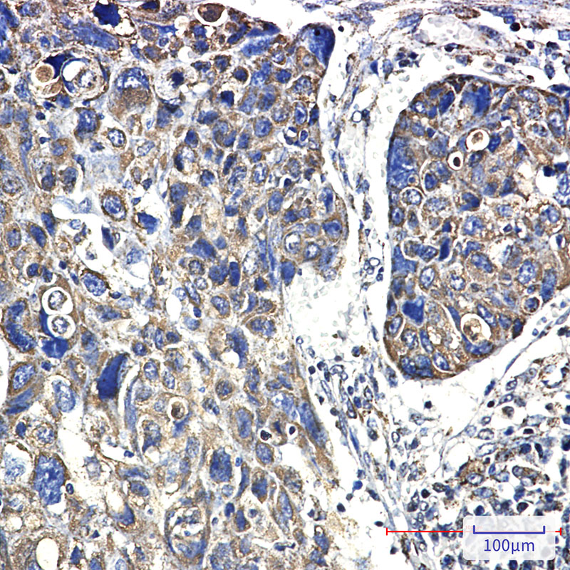 0 - Hsp60 Rabbit mAb AP75581