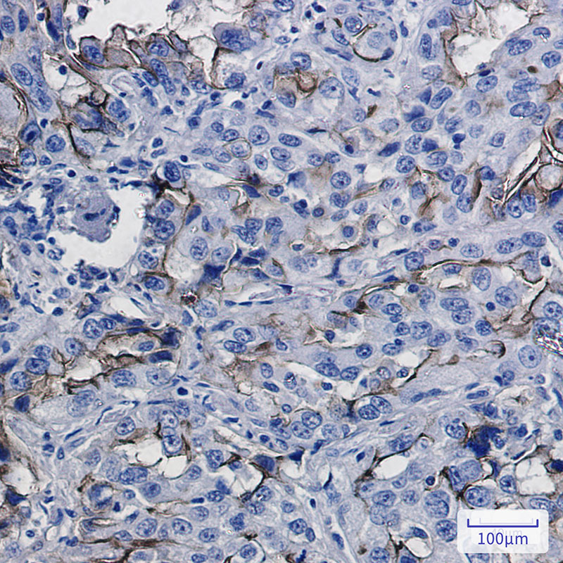 2 - ICAM1 Rabbit mAb AP75590